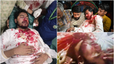 সংঘর্ষে রক্তাক্ত নুর, হাসপাতালে ভর্তি ডাকসুর সাবেক ভিপি