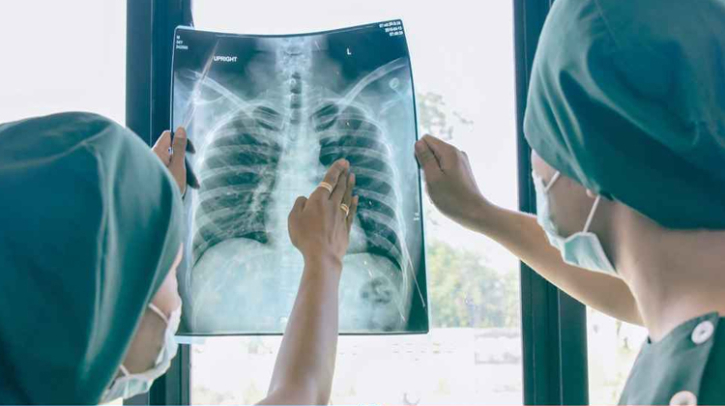 ফুসফুস ক্ষতিগ্রস্ত হতে পারে যেসব কারণে