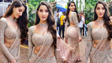 আহত নোরা ফাতেহি, হয়েছে কি ?