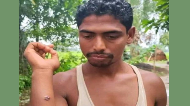 গাইবান্ধায় এক গ্রামেই ১১ ব্যক্তির শরীরে অ্যানথ্রাক্সের উপসর্গ