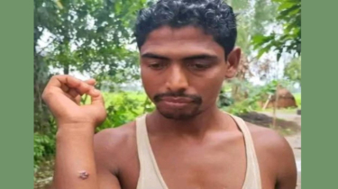 গাইবান্ধায় এক গ্রামেই ১১ ব্যক্তির শরীরে অ্যানথ্রাক্সের উপসর্গ