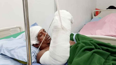 ট্রাক দুর্ঘটনায় হাত বিচ্ছিন্ন, চিকিৎসকরা ফিরিয়ে দিলেন প্রাণ