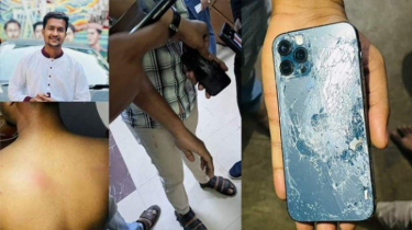 জিডি করতে থানায় গেলে ঢাবি ছাত্রকে পেটায় পুলিশ, আইফোনও ভেঙে যায়