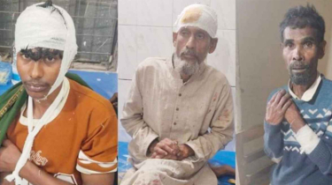 আ.লীগ নেতাদের পিটুনিতে আহত ৫ বিএনপি কর্মী