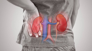 যে ভাবে বুঝবেন আপনার কিডনিতে পাথর হয়েছে কি না