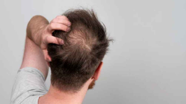 পুরুষদের চুল পড়ার পেছনে লুকিয়ে থাকা ৫ ক্ষতিকর অভ্যাস