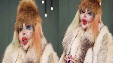 ৩৮৮ বার প্লাস্টিক সার্জারি, সৌন্দর্যের খোঁজে চরম সিদ্ধান্ত