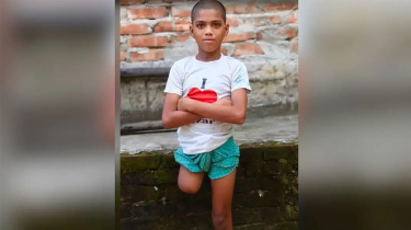 চুল কাটতে বেরিয়ে ৭ মাস পর এক পা হারিয়ে ফিরল ১২ বছরের রায়হান চুল কাটতে বেরিয়ে ৭ মাস পর এক পা হারিয়ে ফিরল ১২ বছরের রায়হান